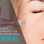Microneedling & Collagen Therapy: The Secret to Glowing Skin